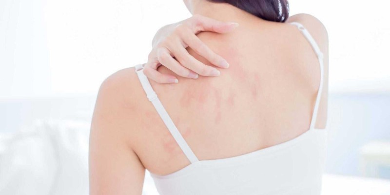 Alergia na pele: principais causas e como tratar