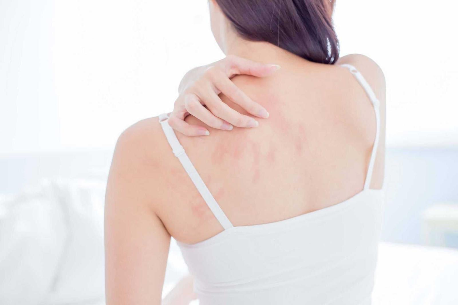 Alergia na pele: principais causas e como tratar